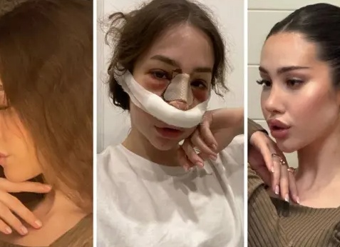 6 звезд, которые сильно изменились: нанять стилиста и стать новым человеком (перемены не всегда на пользу)